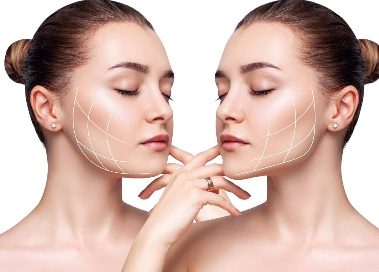 Everything You Need to Know About Chin Fillers in Dubai