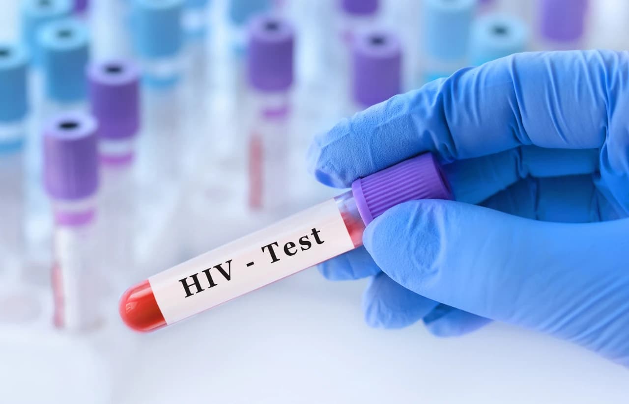 Early Signs and Symptoms of HIV