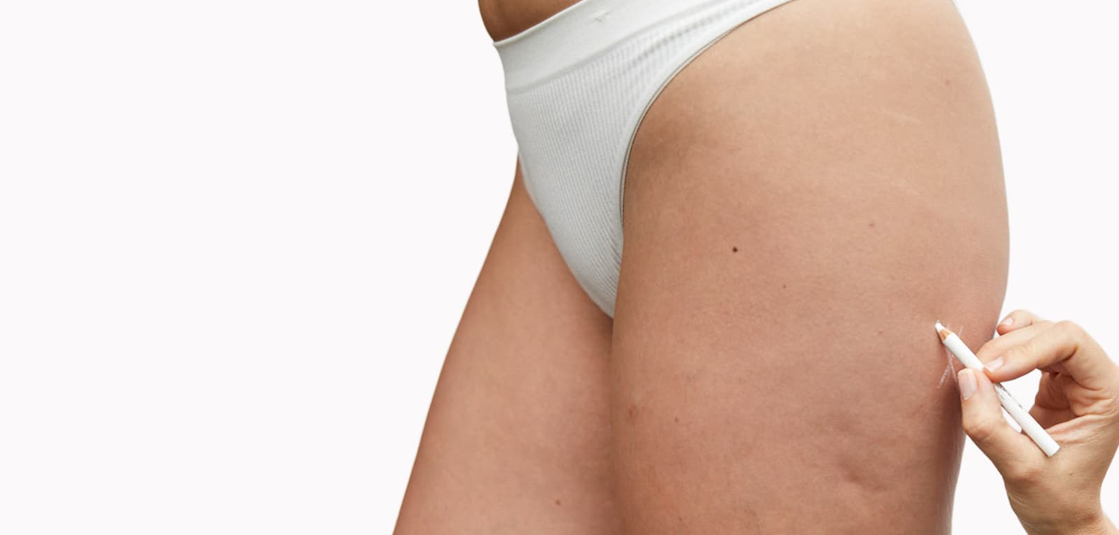 Cellulite Treatment in Dubai & Abu Dhabi
