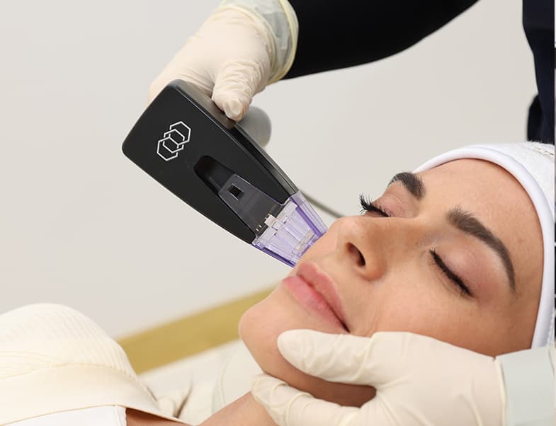 Laser hair removal