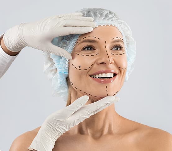 Facelift