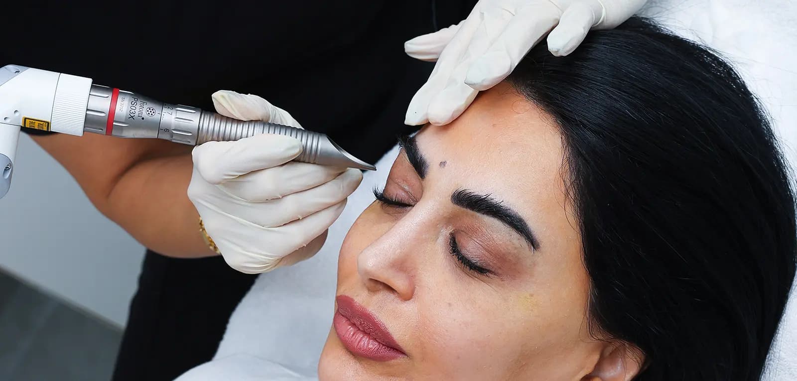 Laser & Energy-Based Treatments