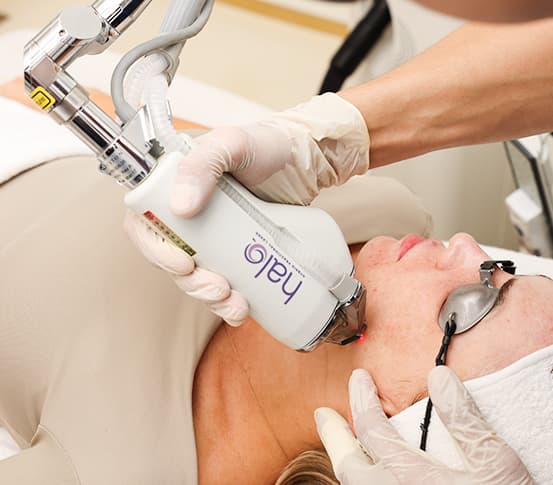 Treatment area
