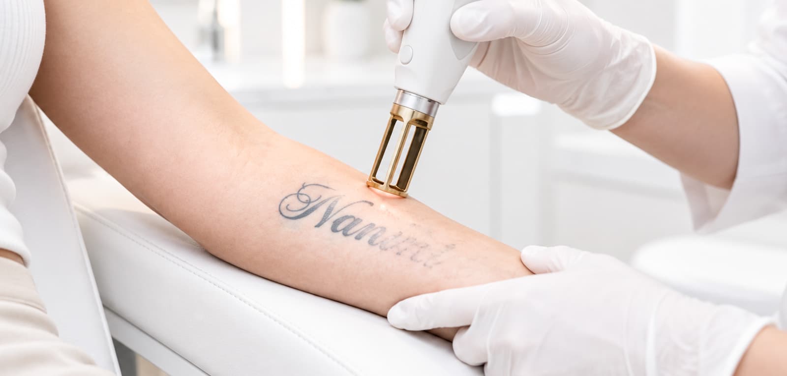 Laser Tattoo Removal in Dubai & Abu Dhabi