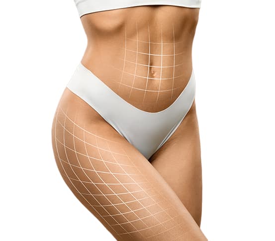 Liposuction