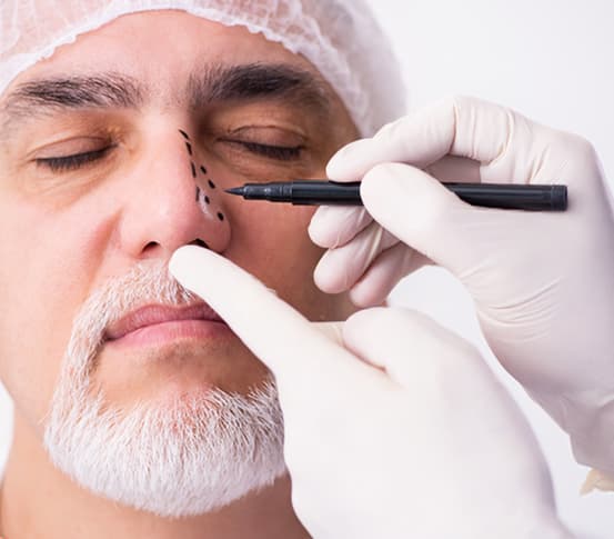 Plastic Surgery
