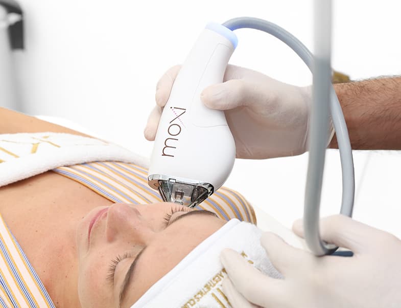 Laser hair removal