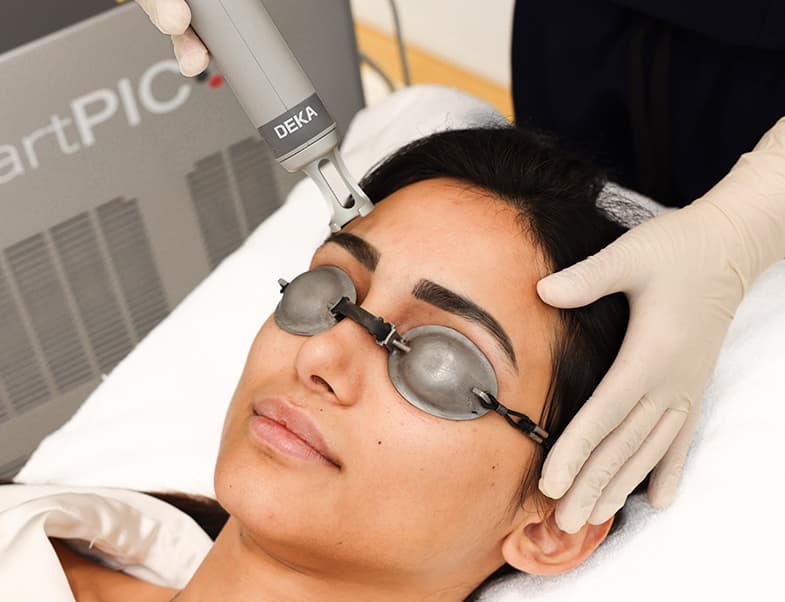 Laser hair removal