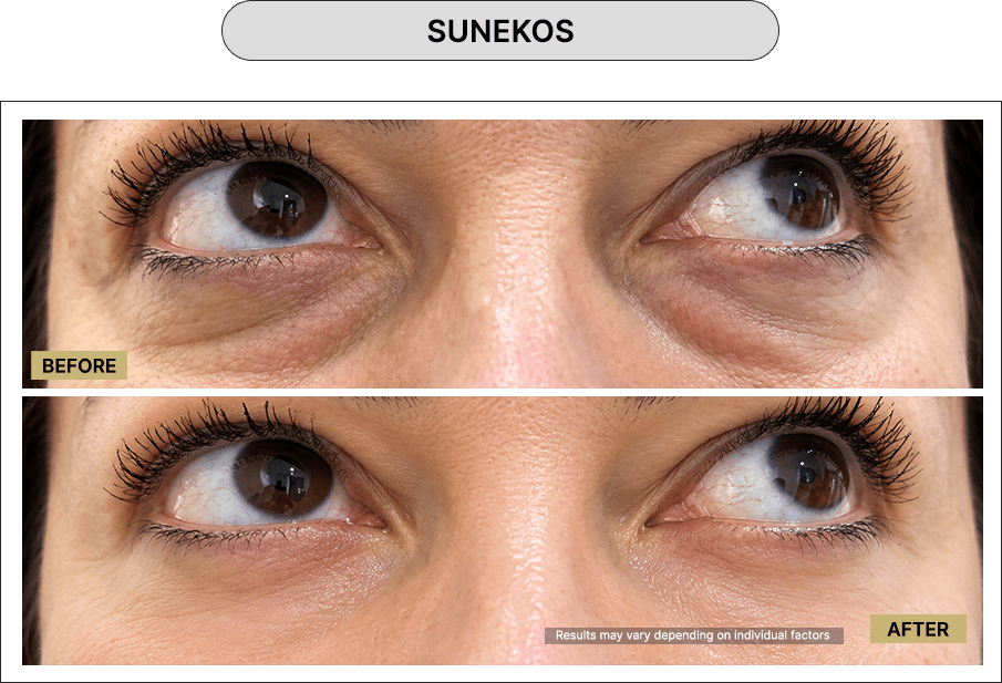 Skin111