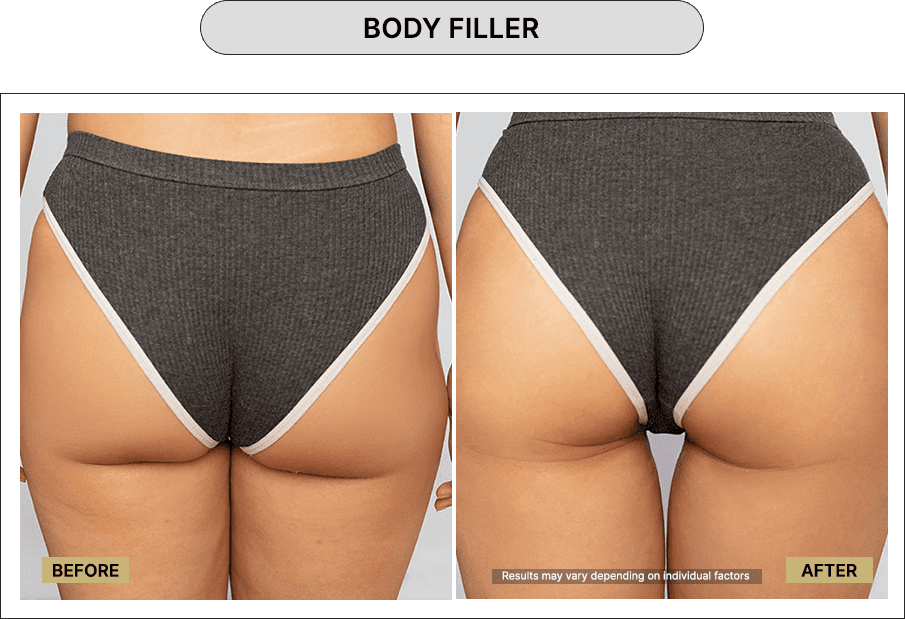 Body Filler