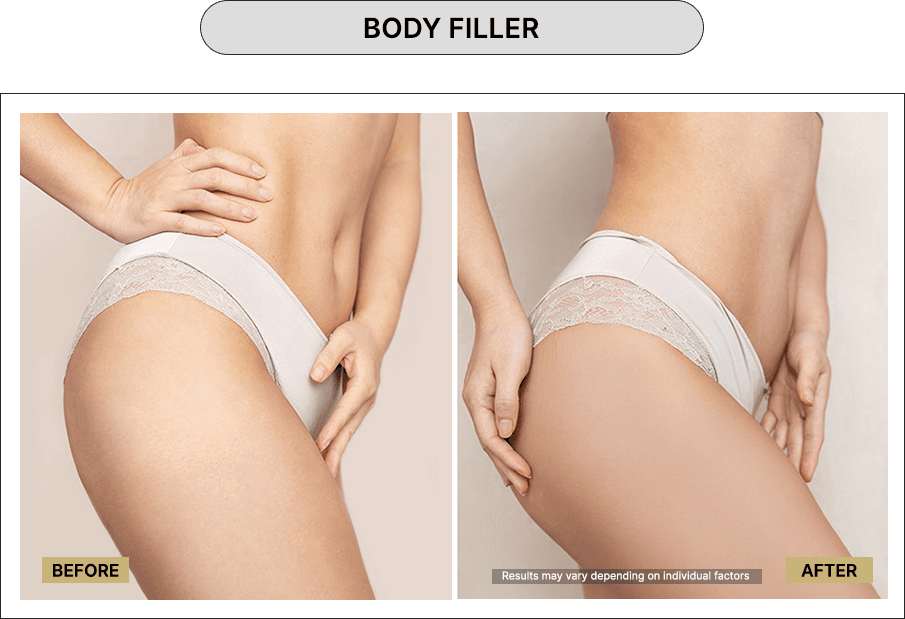 Body Filler