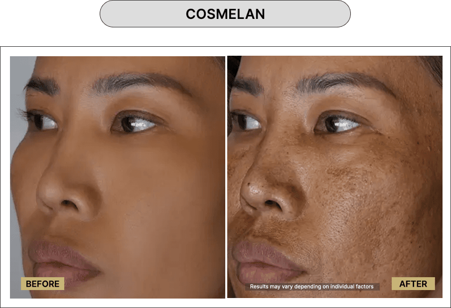 Cosmelan