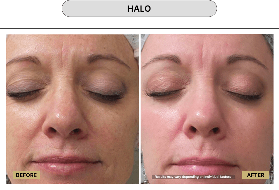 Halo