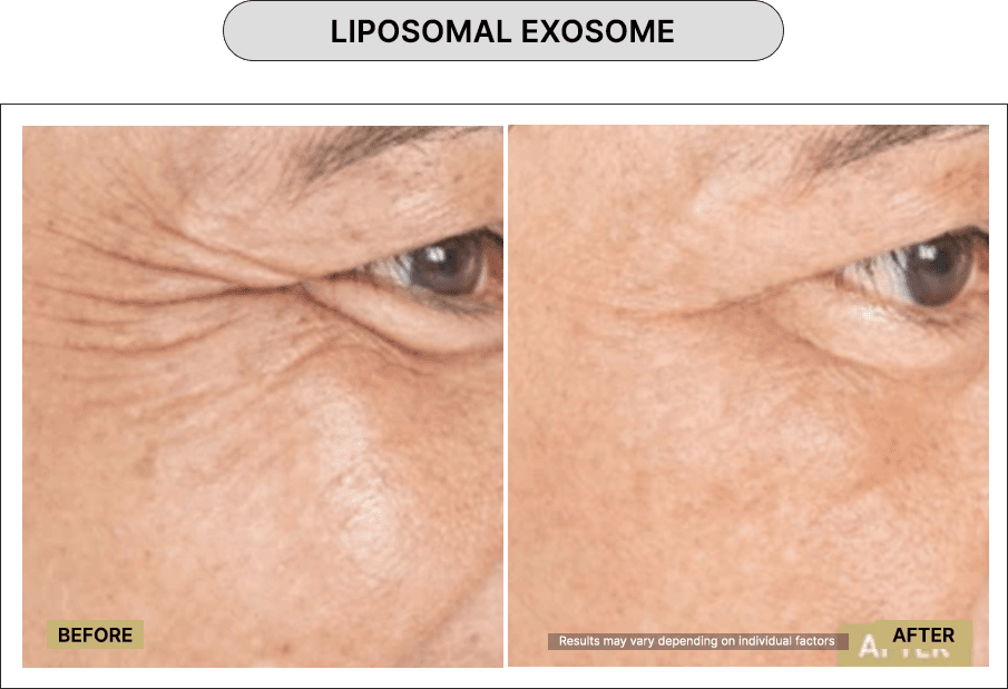 Liposomal exosome