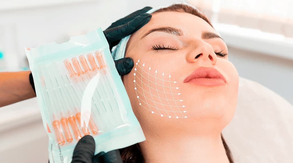 Revolutionizing Rejuvenation: PDO Thread Lifts for a Youthful, Natural Look