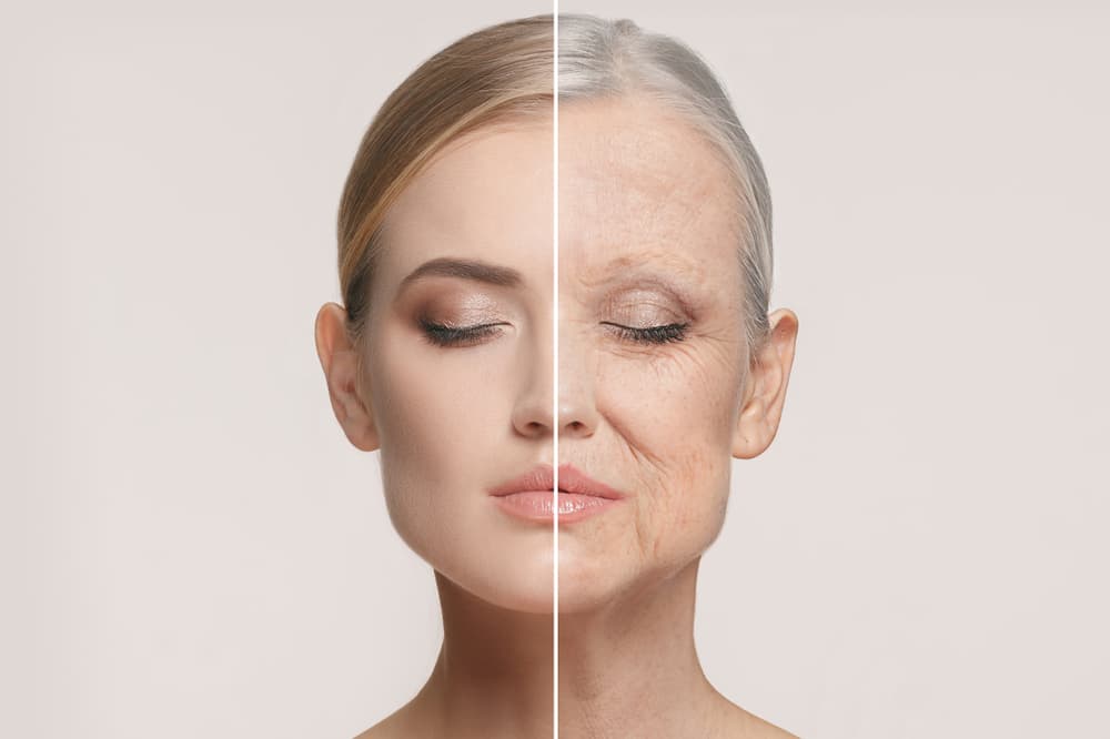 Wrinkles - Causes, Treatment, and Prevention