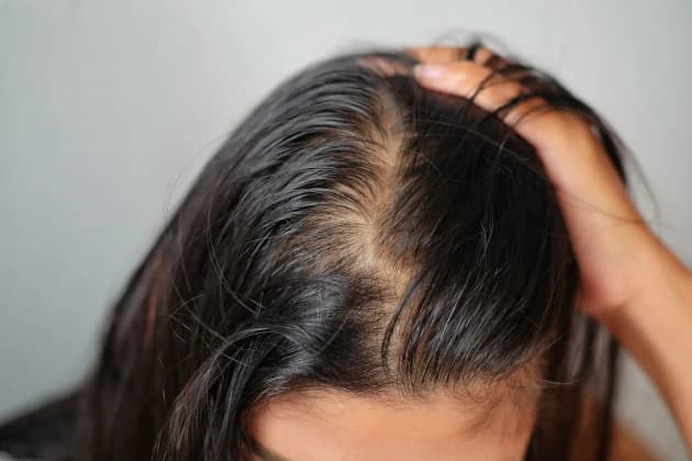 Thinning Hair: Causes, Treatment, and More