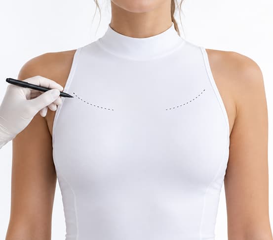 Breast Augmentation