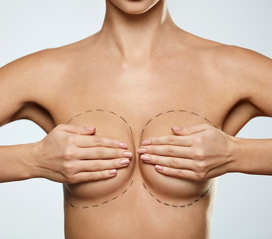 Breast Augmentation