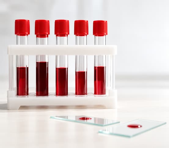 Diagnostics