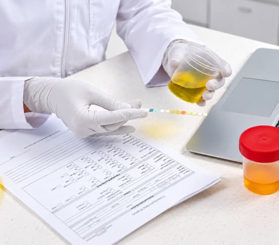 Organic Acid Test