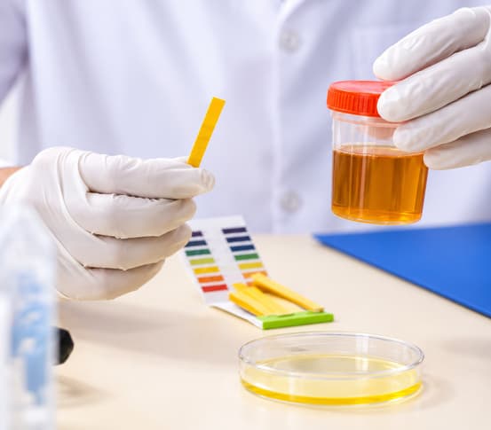 Organic Acid Test