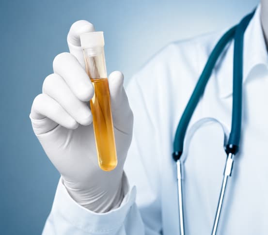 Organic Acid Test