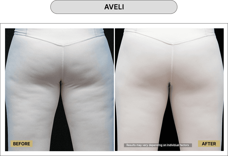 Aveli
