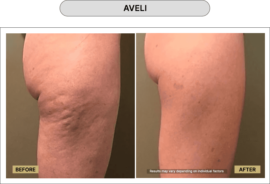 Aveli