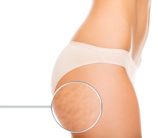 Weight Loss Treatment