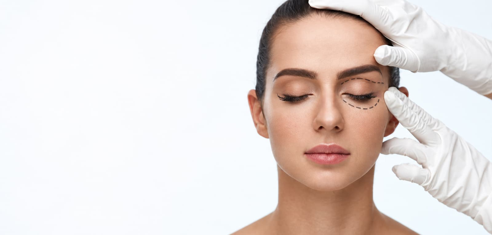Blepharoplasty in Dubai & Abu Dhabi