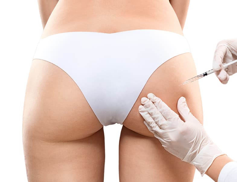 Laser hair removal