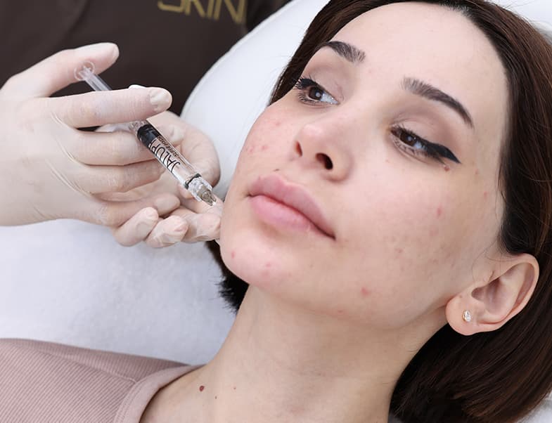 Laser hair removal