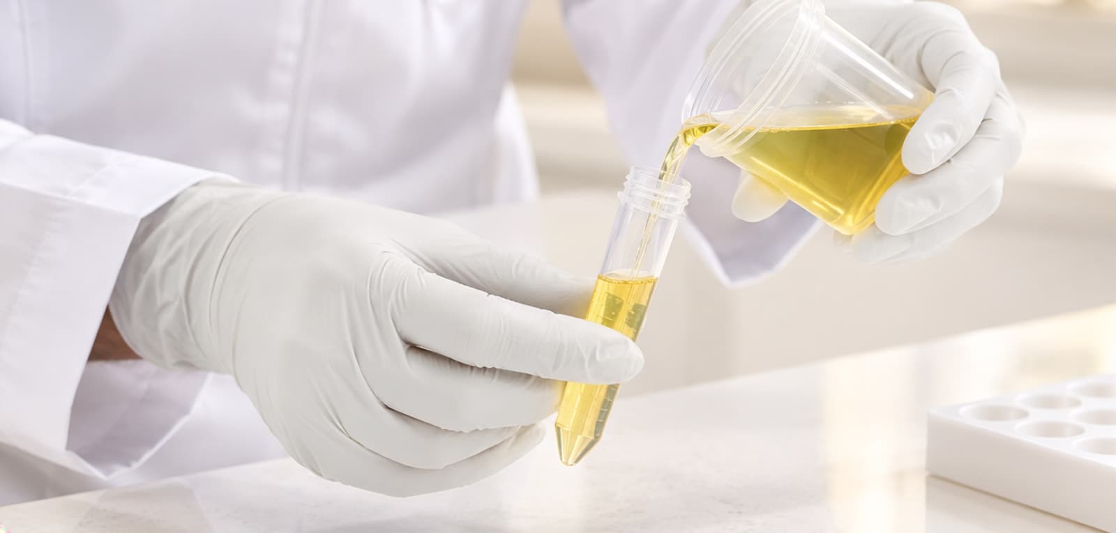 Organic Acid Test (OAT) in Dubai & Abu Dhabi