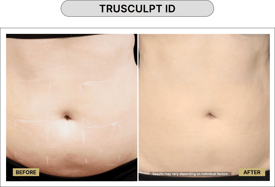 Skin111