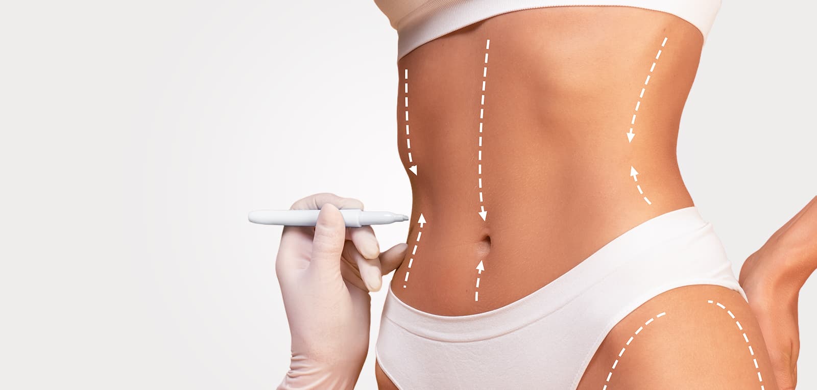 VASER Liposuction in Dubai