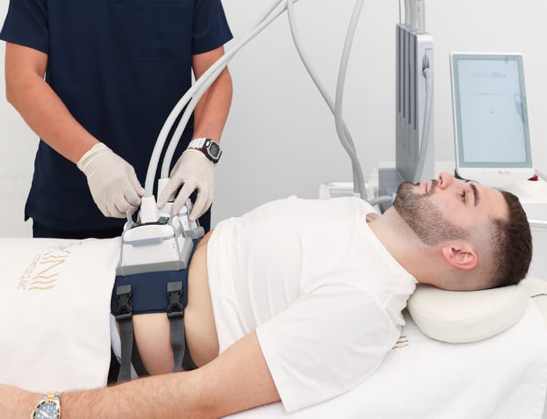 Laser hair removal