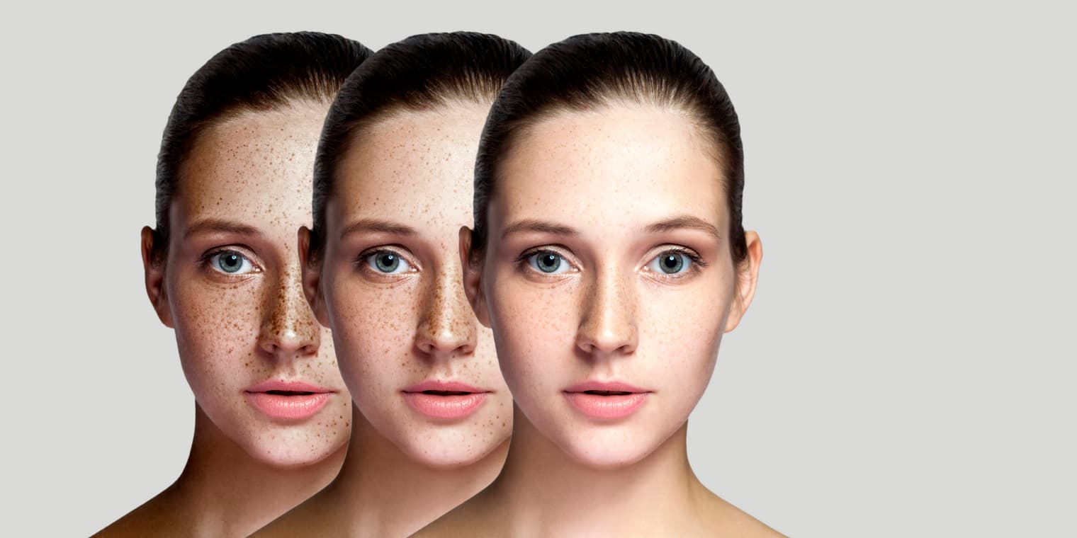 Skin111