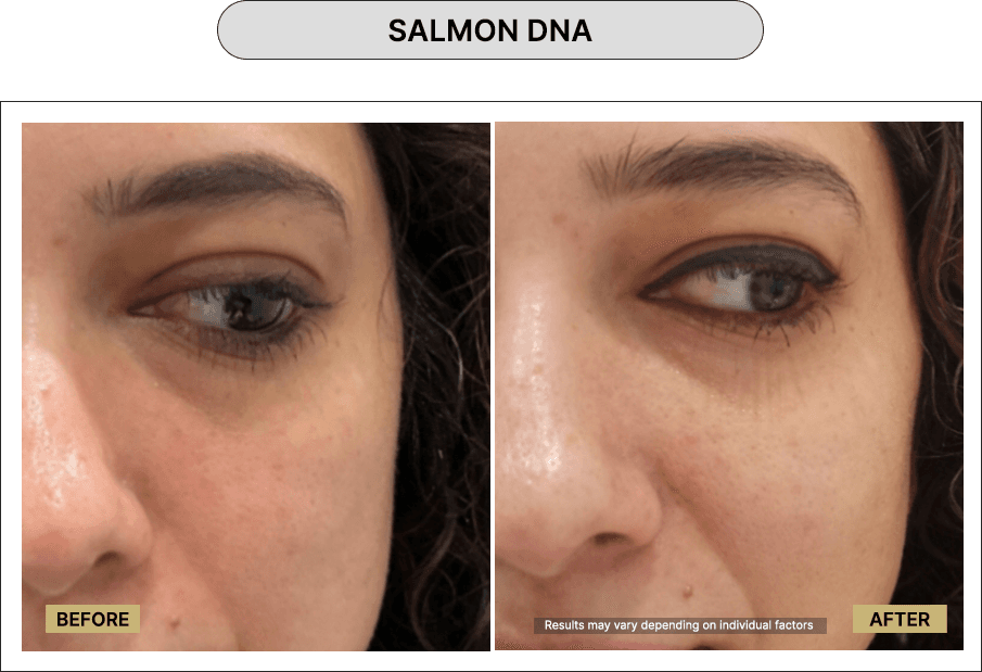Salmon DNA
