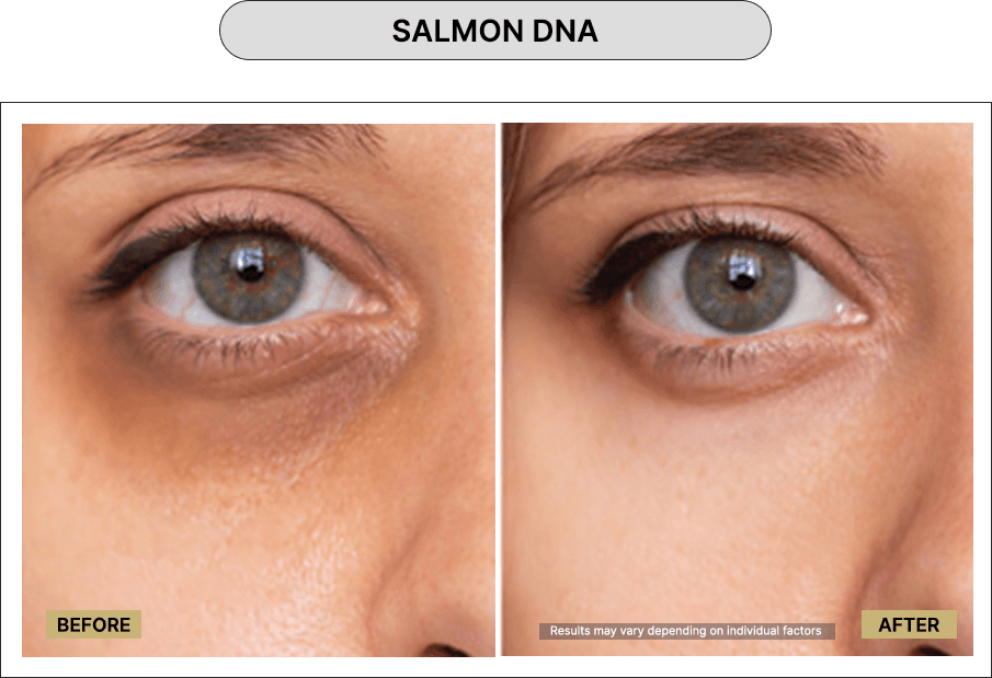 Salmon DNA