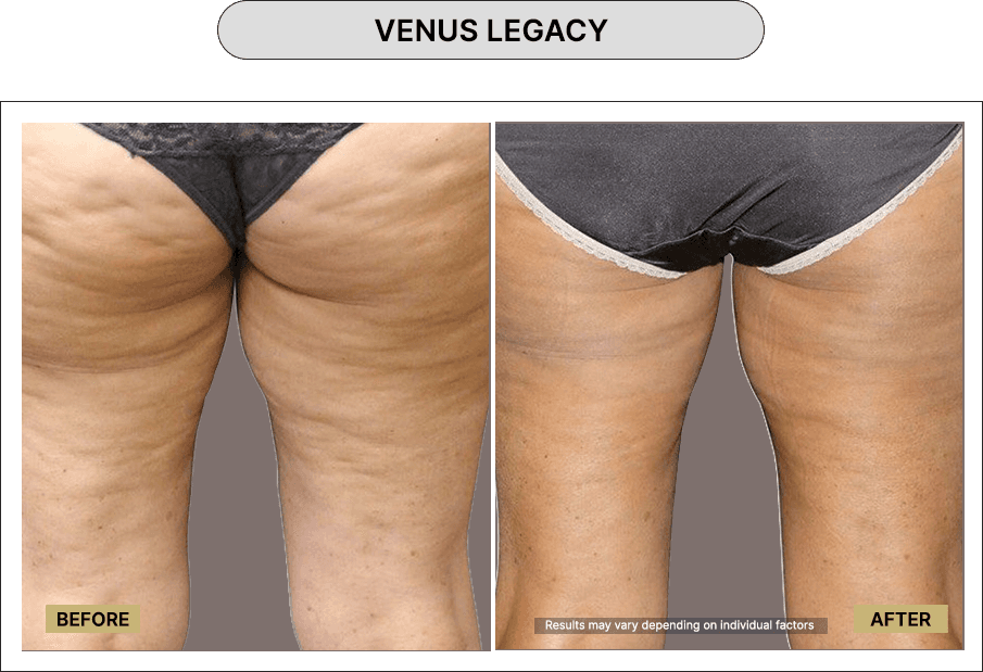 Venus Legacy
