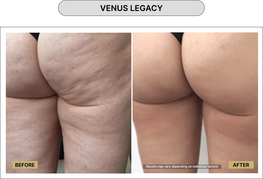 Venus Legacy