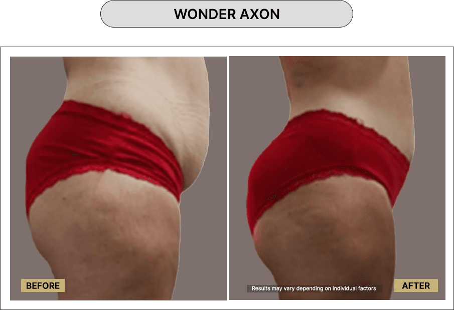 Wonder Axon