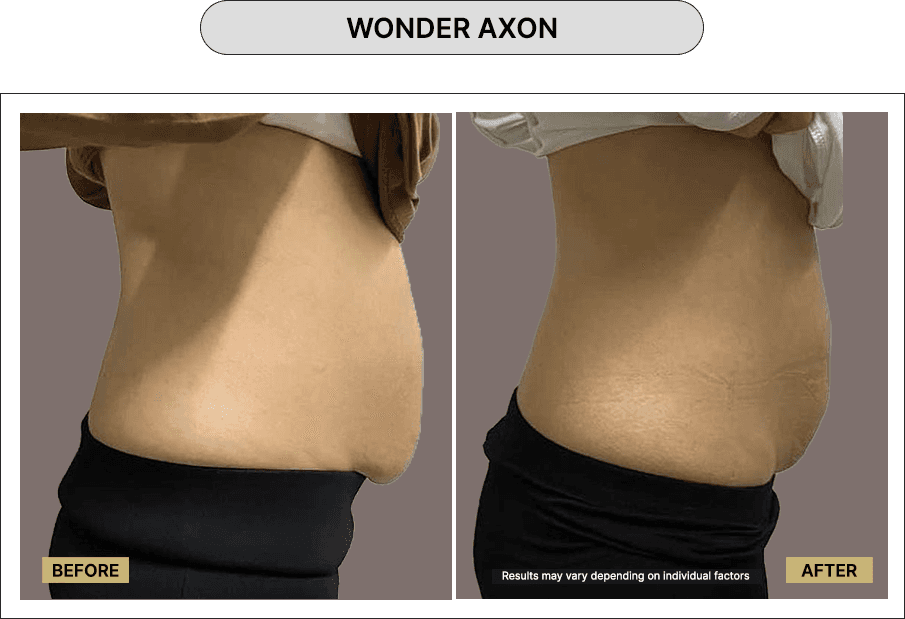 Wonder Axon