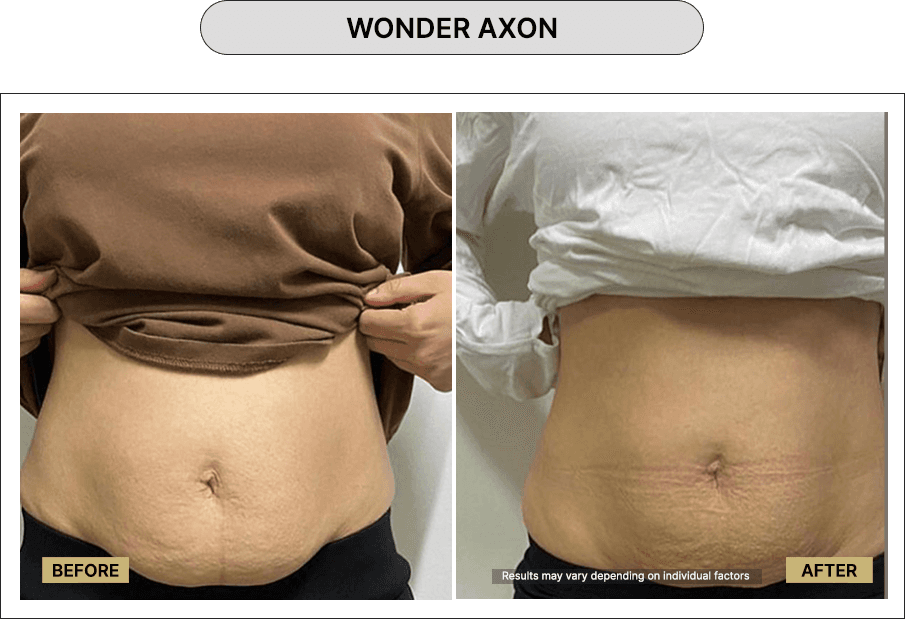 Wonder Axon