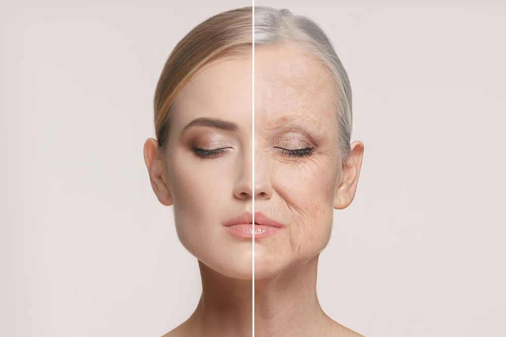 Wrinkles: Causes, Treatment & How to Get Rid of Them?