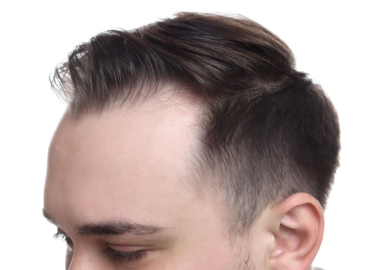 Everything You Need to Know About Hair Transplant Clinics in Dubai