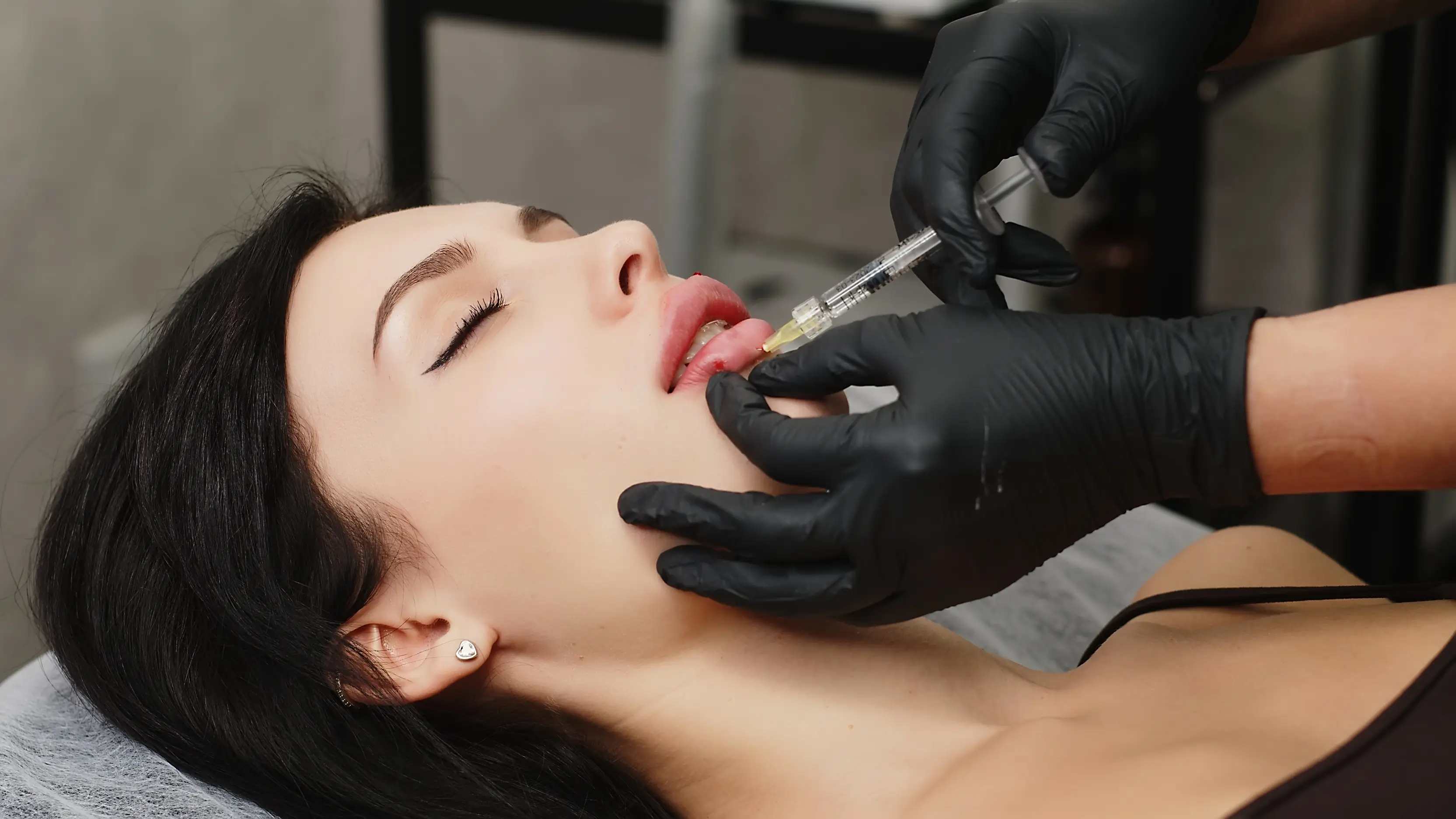 Understanding Lip Filler Treatment Options