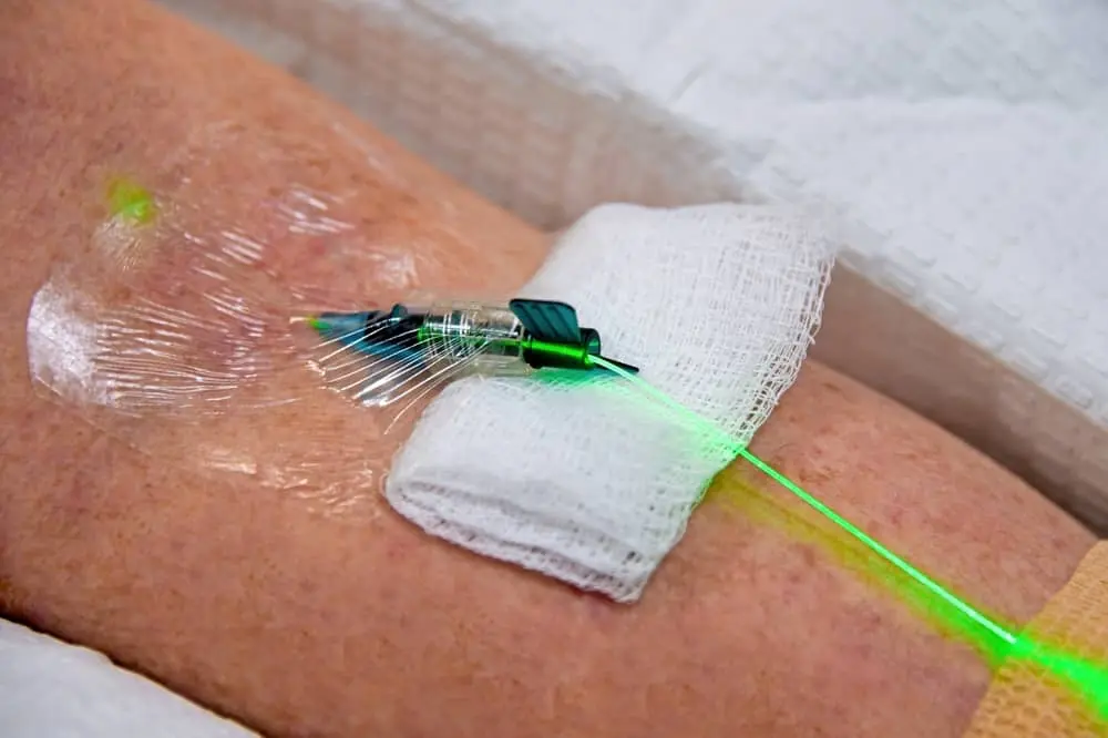 IV Laser Therapy: Types, Benefits & More 