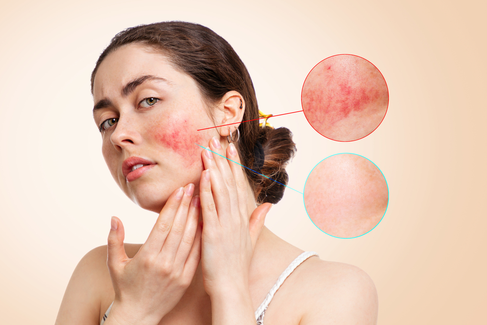 Sensitive Skin  Symptoms Causes Treatments